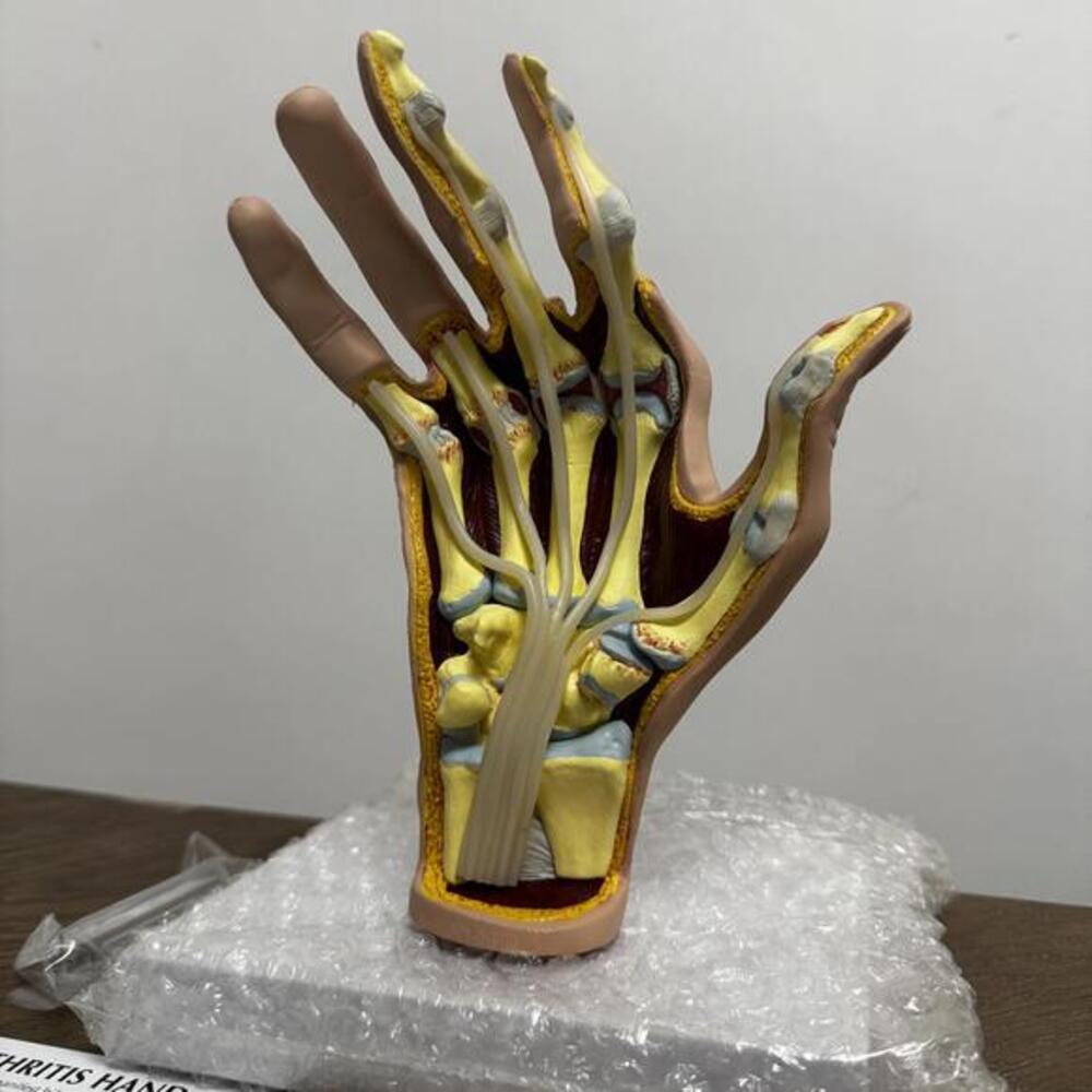 Vintage Anatomical Human Hand Nerve and Bone Model for Science Education